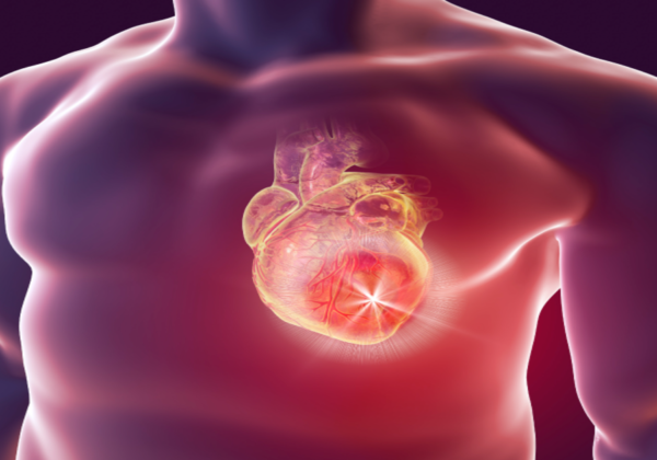 Can Heart Cancer kill fast?