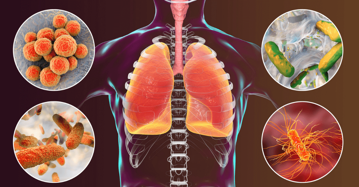 Lung Infection Disease - Healthlifenews