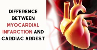 myocardial infarction and cardiac arrest - Healthlifenews