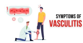 Symptoms of Vasculitis - Healthlifenews