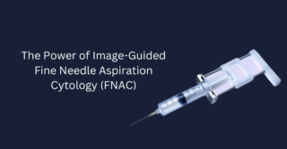 The Power of Image-Guided Fine Needle Aspiration Cytology (FNAC)